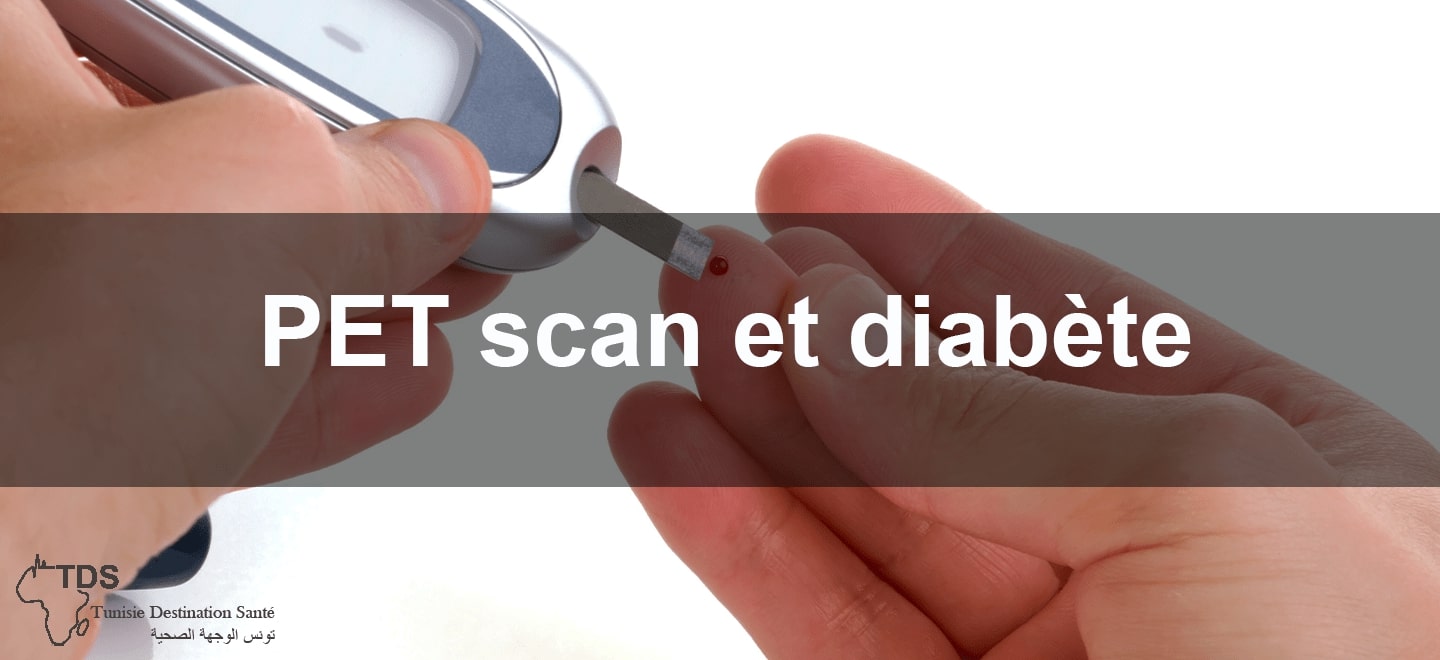 PET scan et diabète