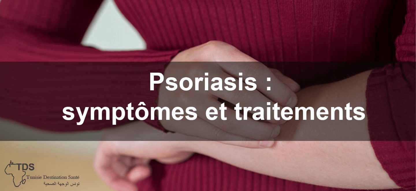 Psoriasis symptomes et traitements