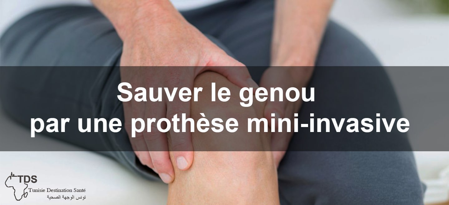 Sauver le genou par une prothese mini invasive