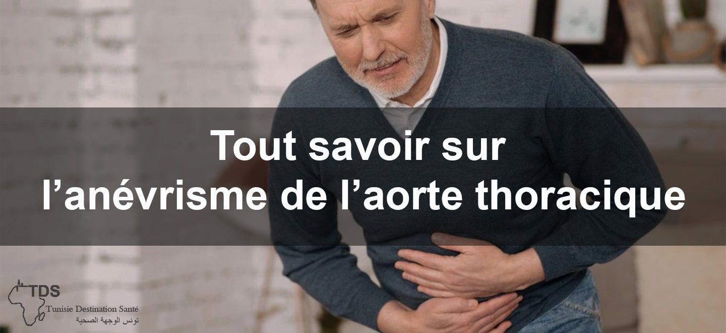 Tout savoir sur lanevrisme de laorte thoracique