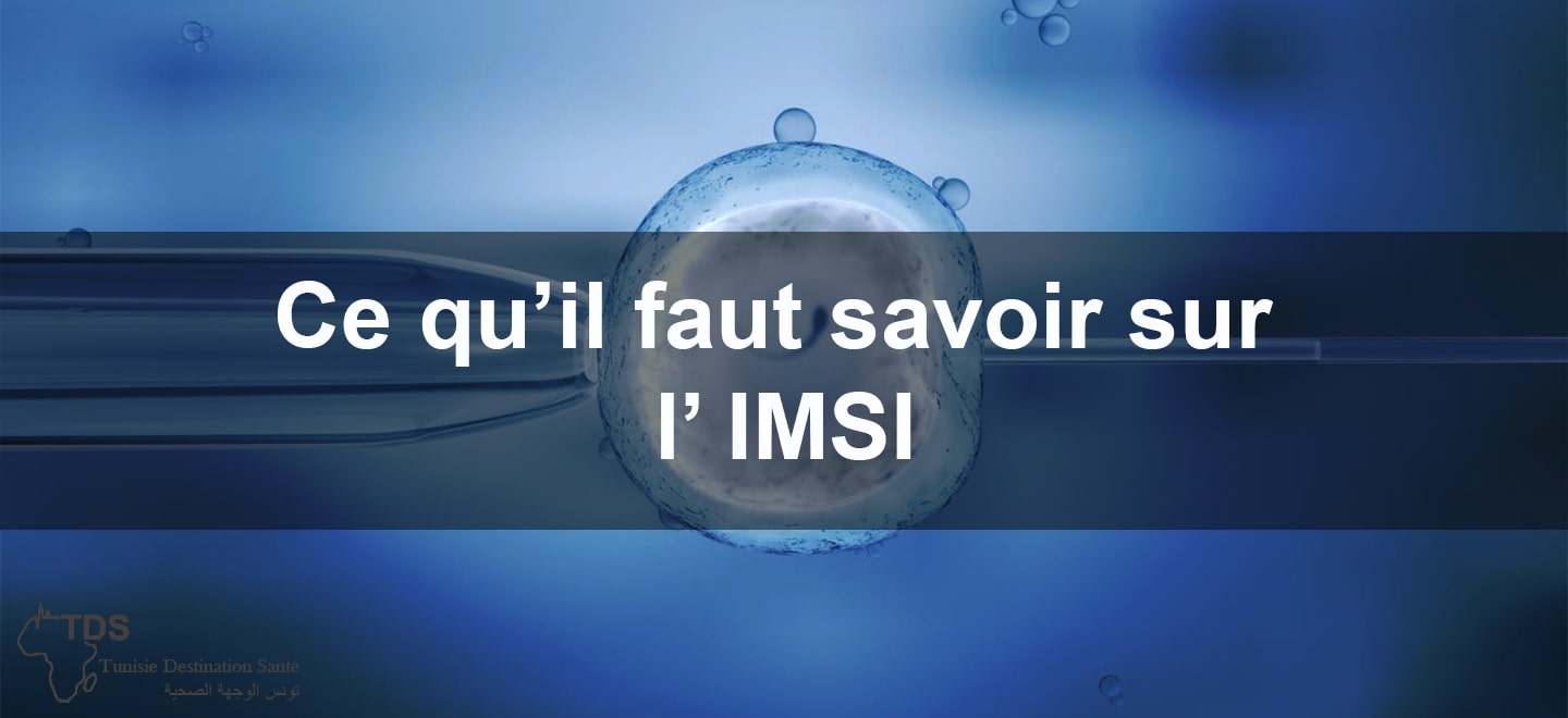 ce qu il faut savoir sur lIMSI