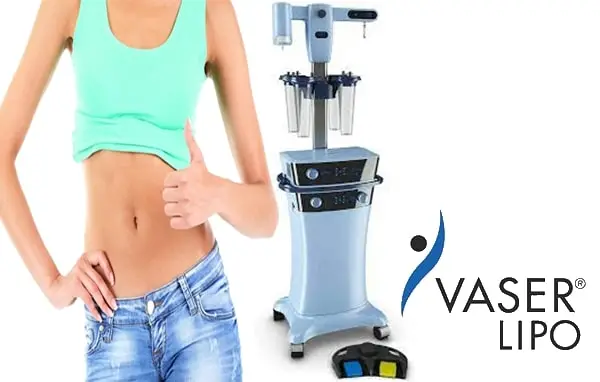 Liposuccion vaser