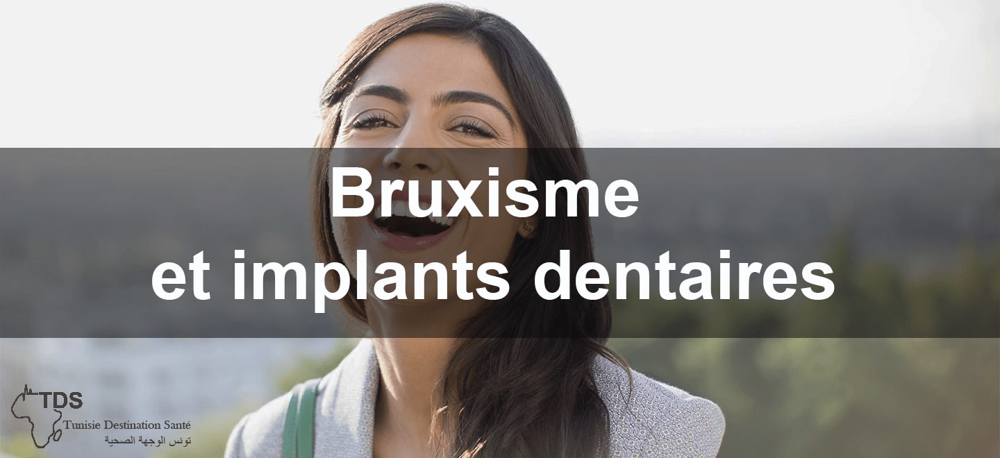 Bruxisme et implants dentaires