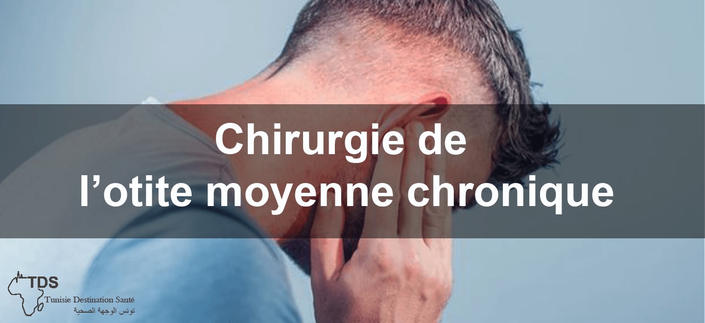 chirurgie de lotite moyenne chronique