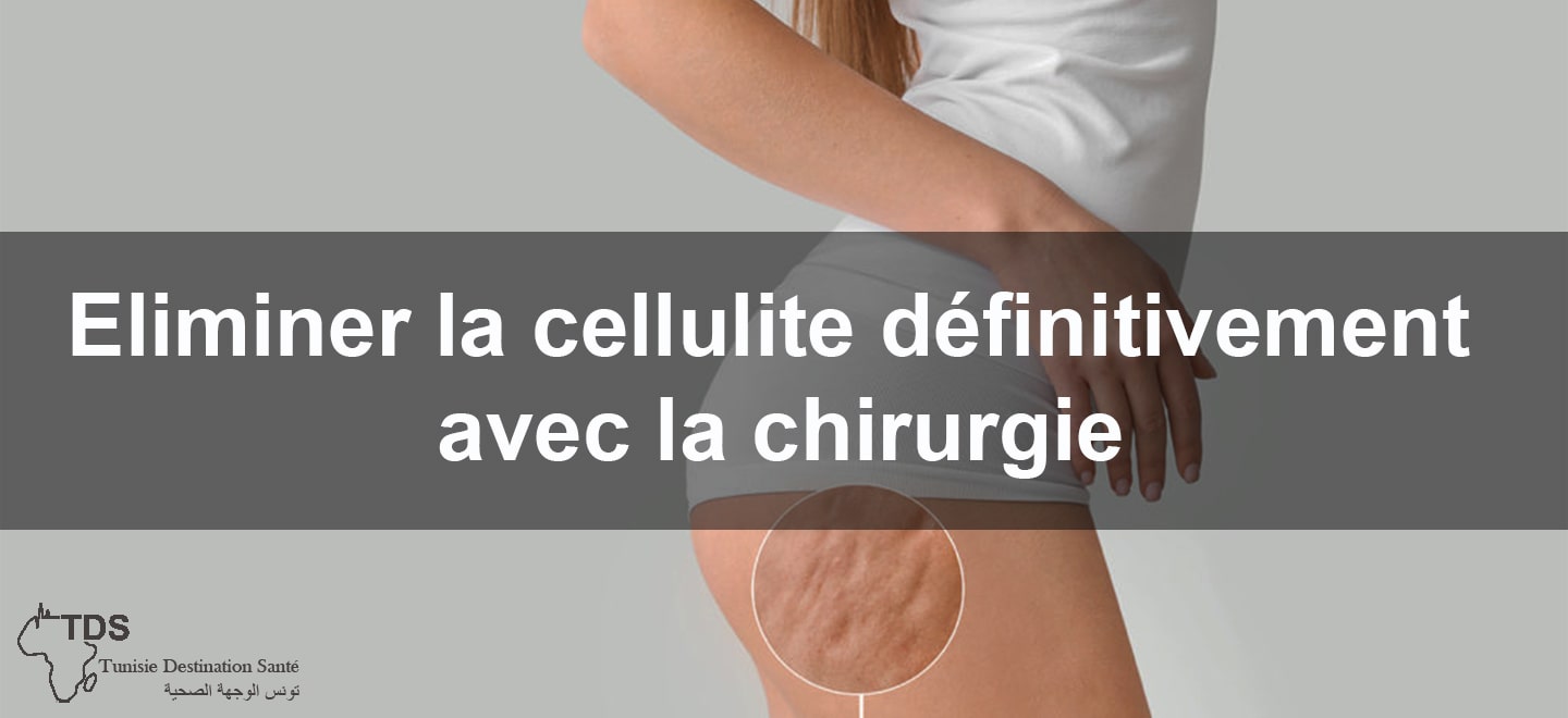 Eliminer la cellulite definitivement avec la-chirurgie