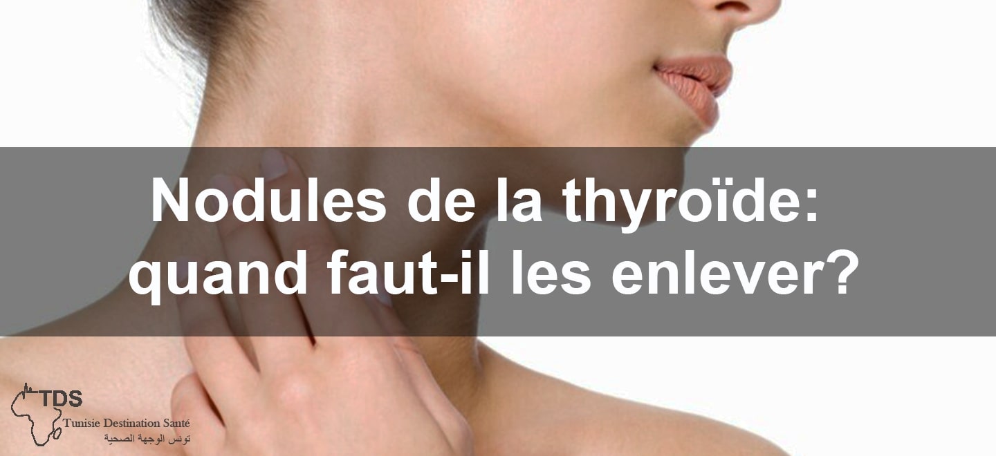 Nodules de la thyroide quand faut il les enlever