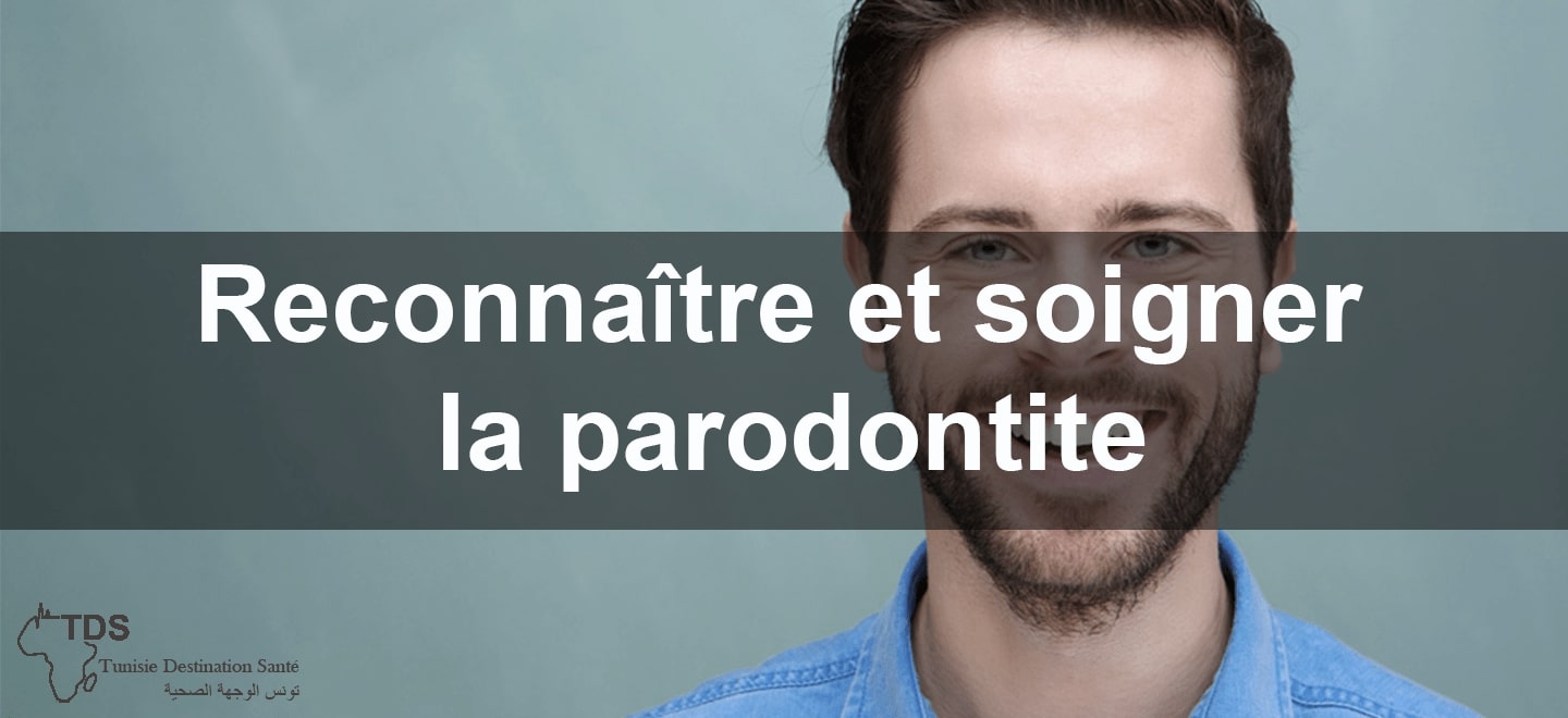 Reconnaitre et soigner la parodontite