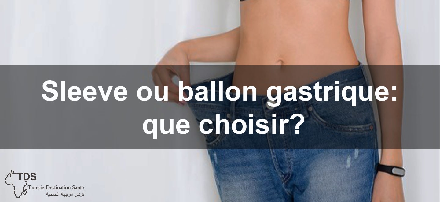 Sleeve ou ballon gastrique que choisir