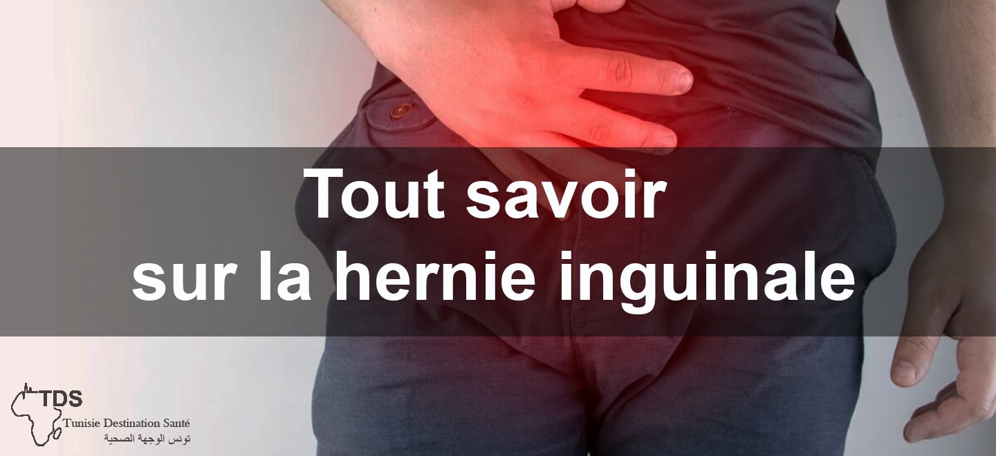 Hernie Inguinale : Causes, Symptômes et Traitements