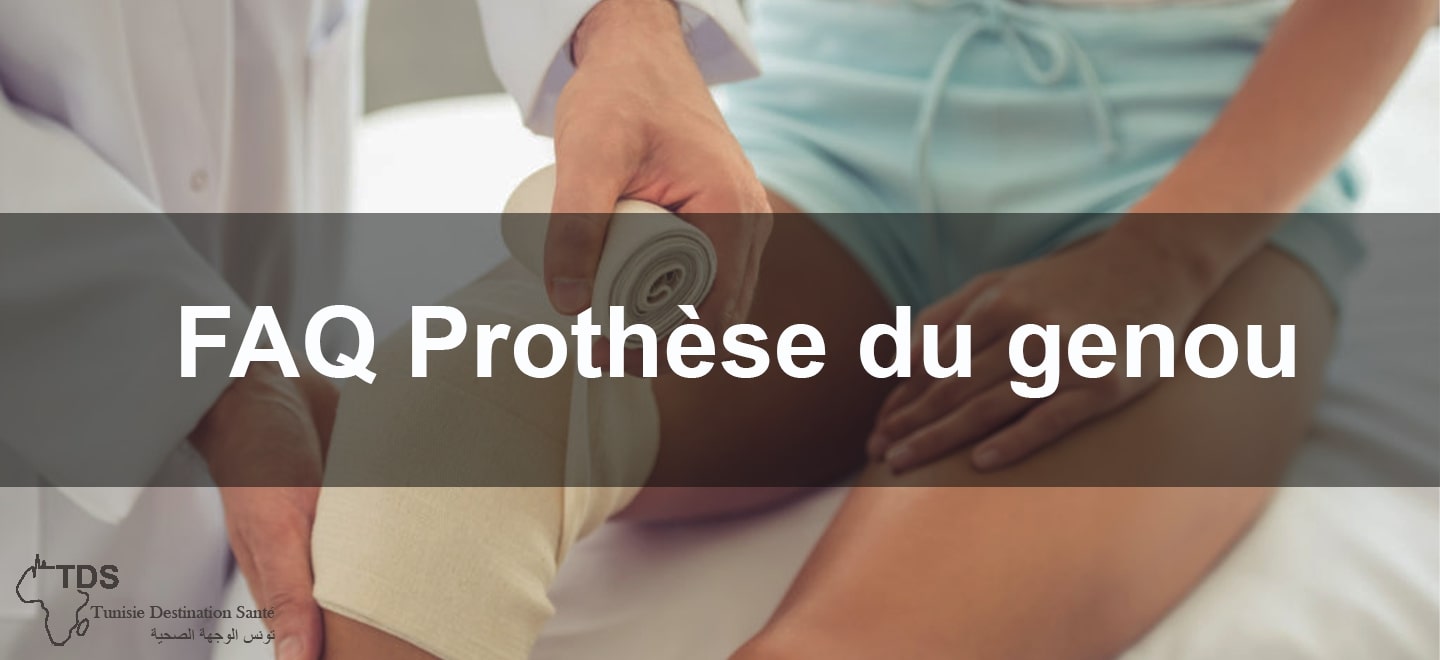 FAQ Prothese du genou