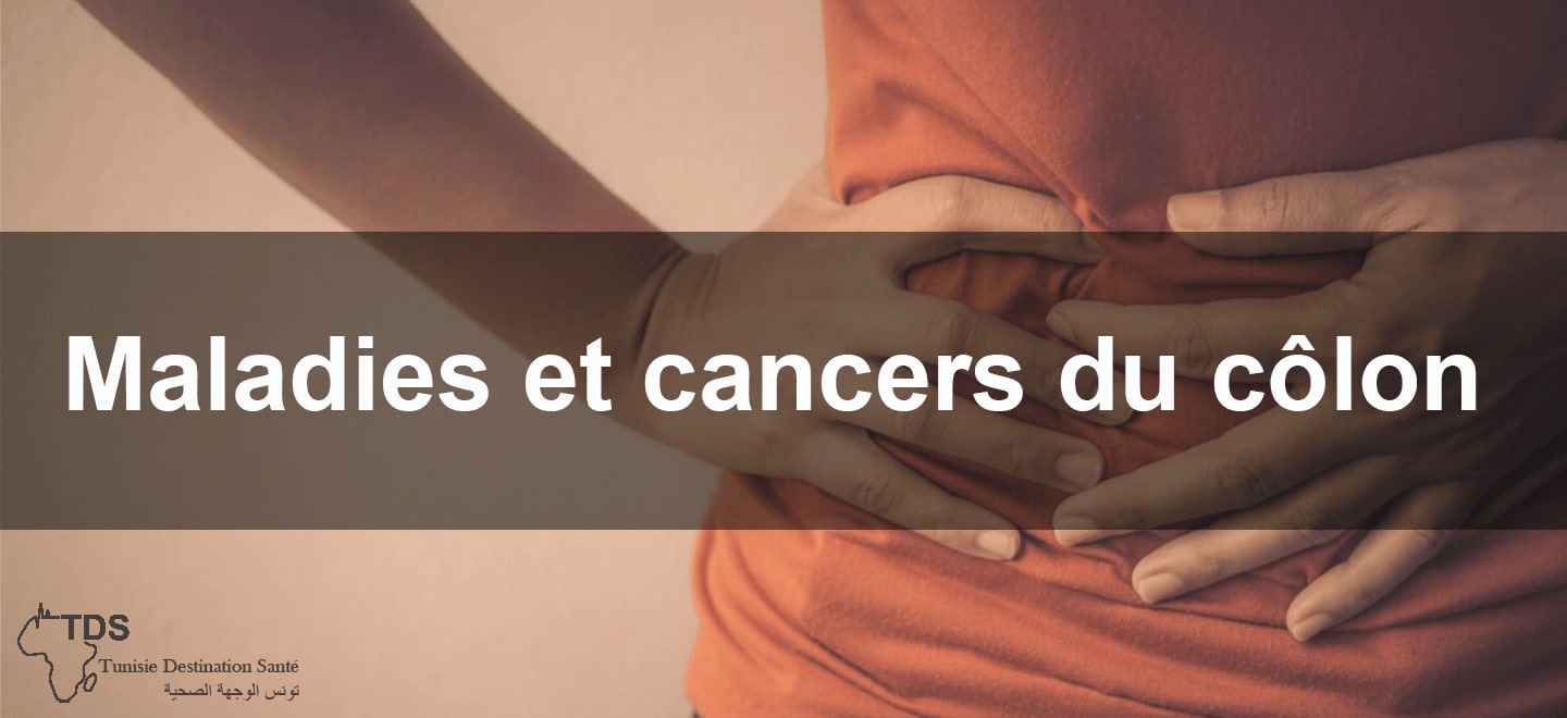 maladie et cancer du colon