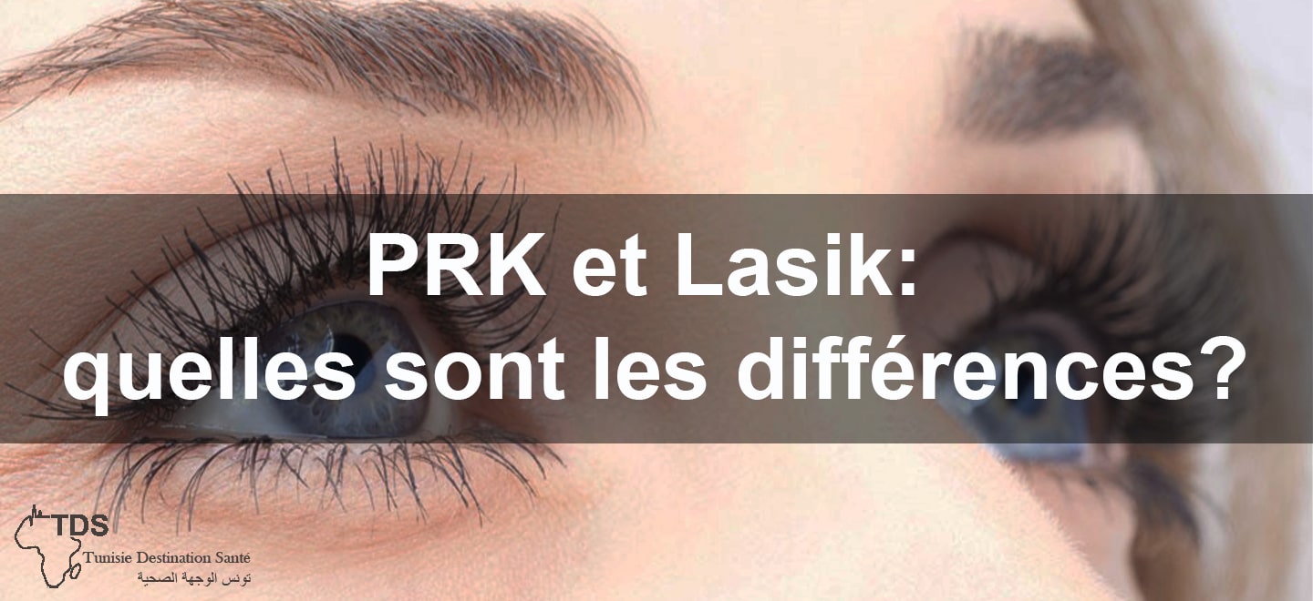 PRK et Lasik quelle sont les differences