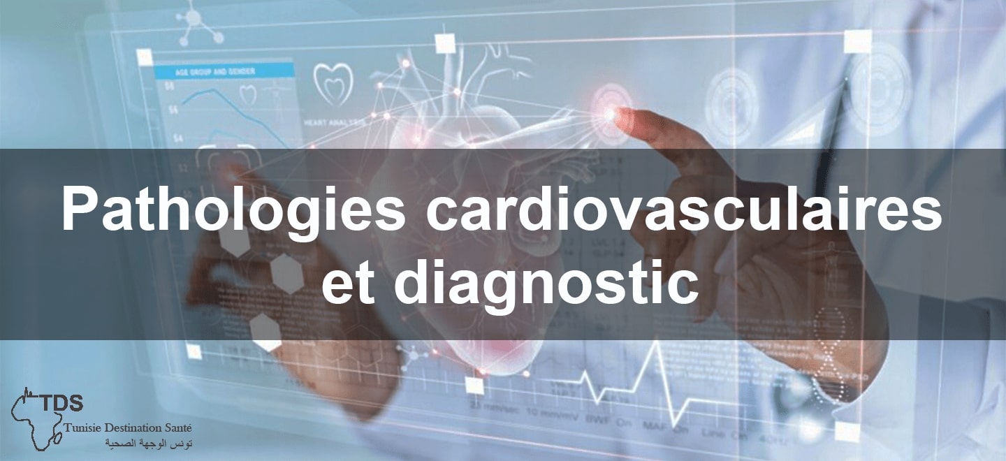 Pathologies cardiovasculaires