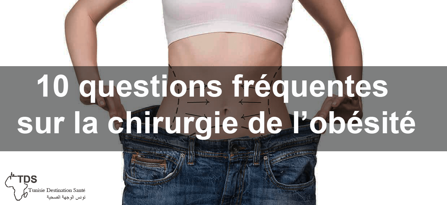 10 questions fréquentes sur la chirurgie de l'obésité