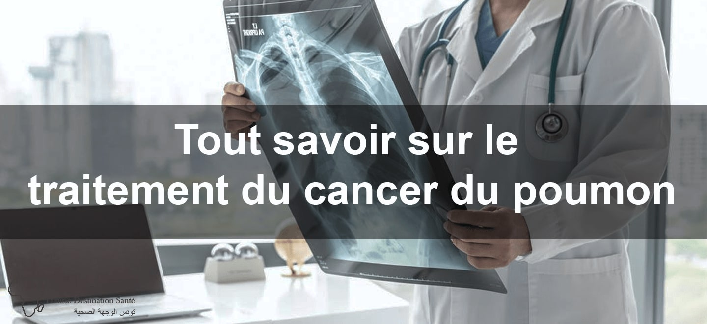 traitement du cancer du poumon