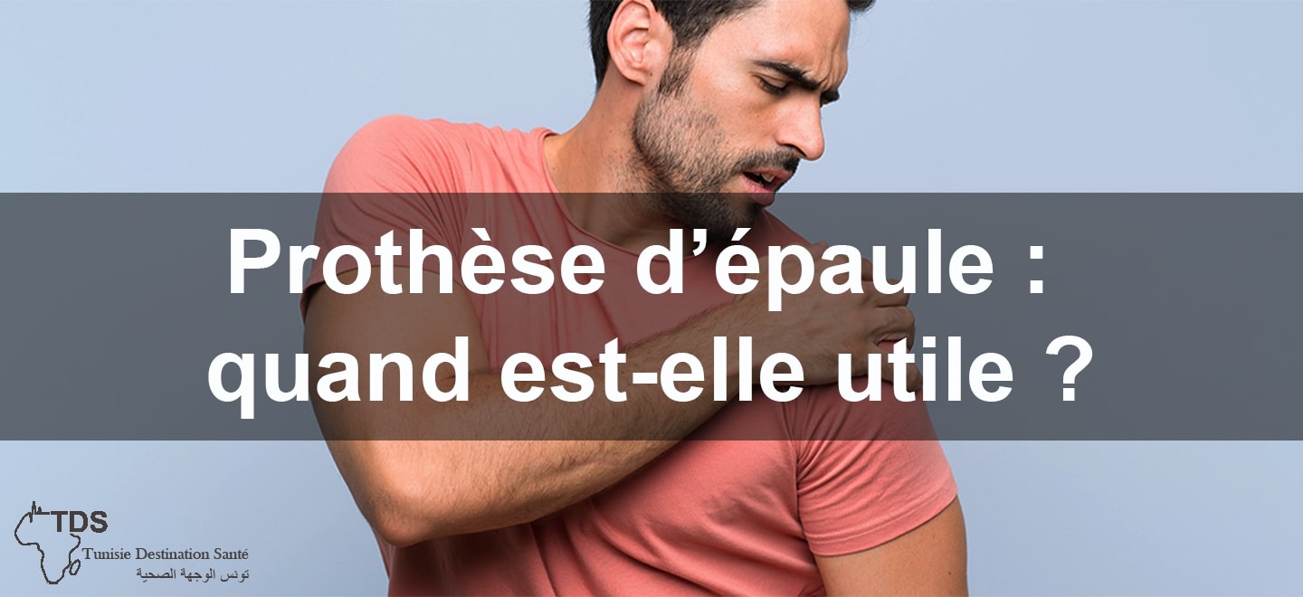 Prothese depaule quand est elle utile