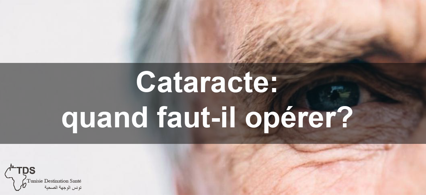 Cataracte-quand faut-il opérer