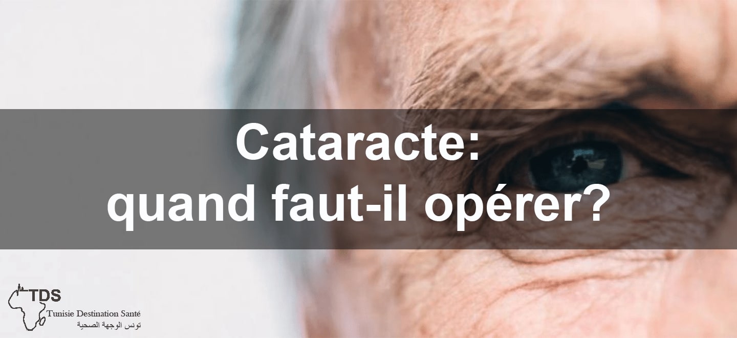 cataracte : quand opérer
