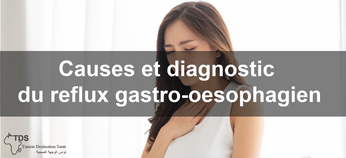 Causes et diagnostic du reflux gastro-oesophagien