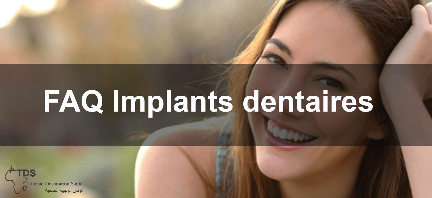 FAQ Implants dentaires