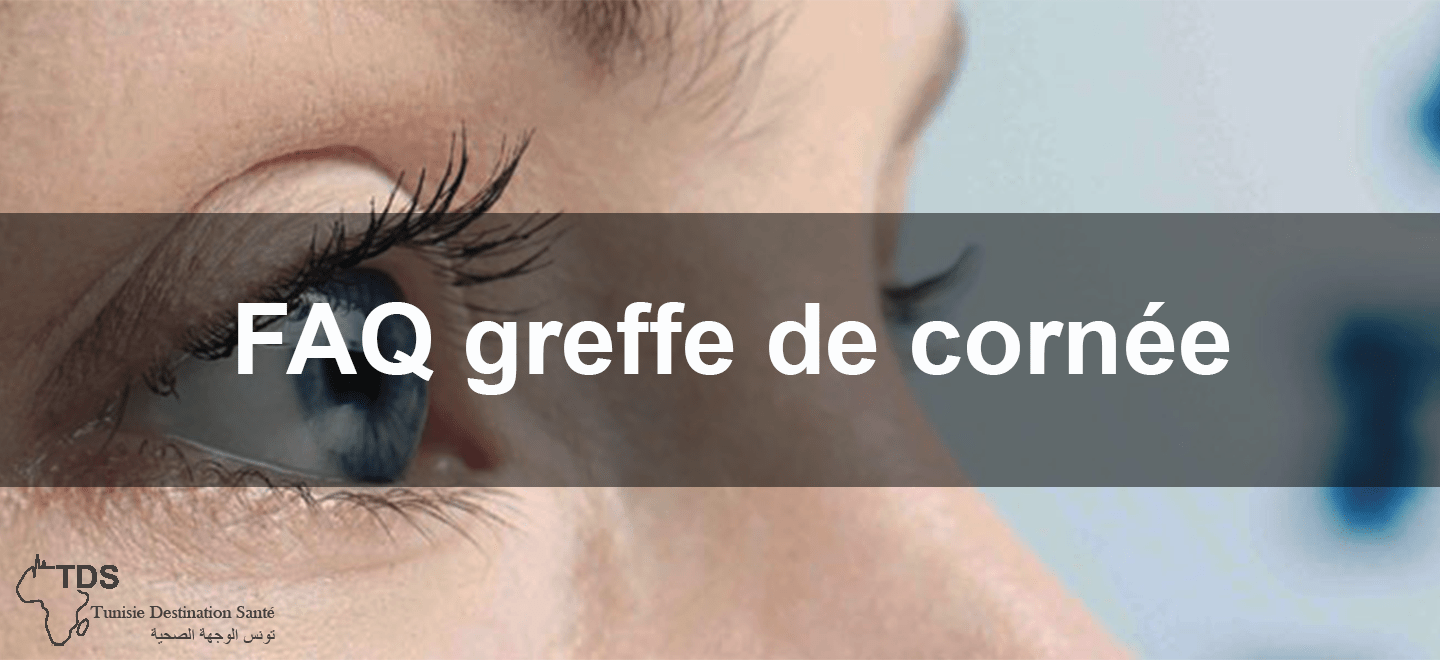 FAQ greffe de cornée