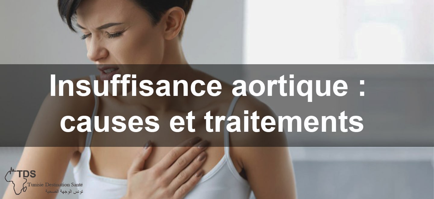 Insuffisance aortique causes et traitements