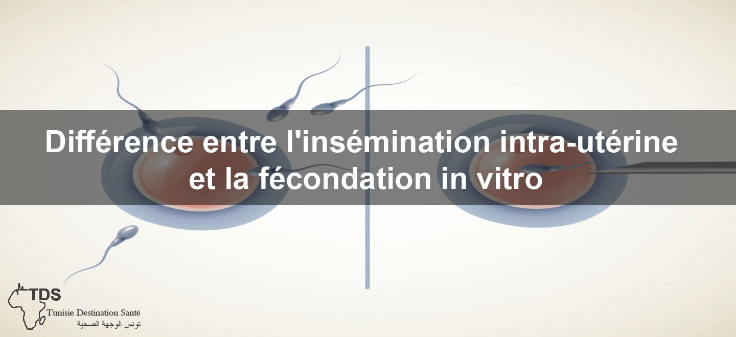 difference insemination fiv