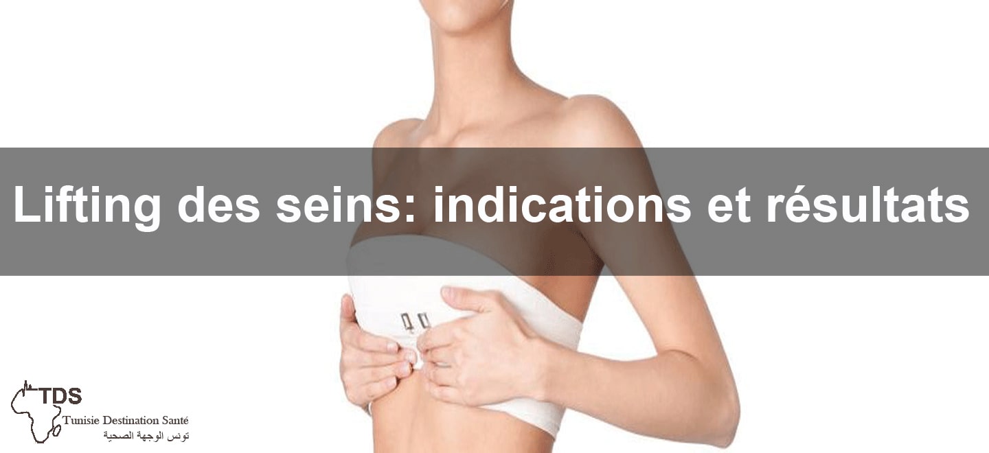 lifting seins indication resultat