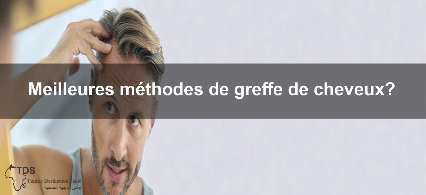 methodes greffe cheveux