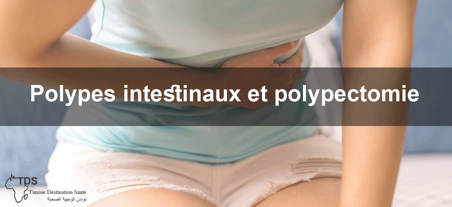 polypes intestinaux polypectomie