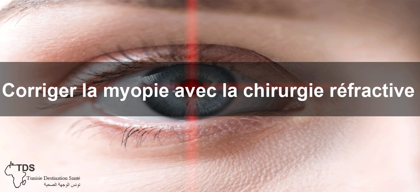 chirurgie refractive