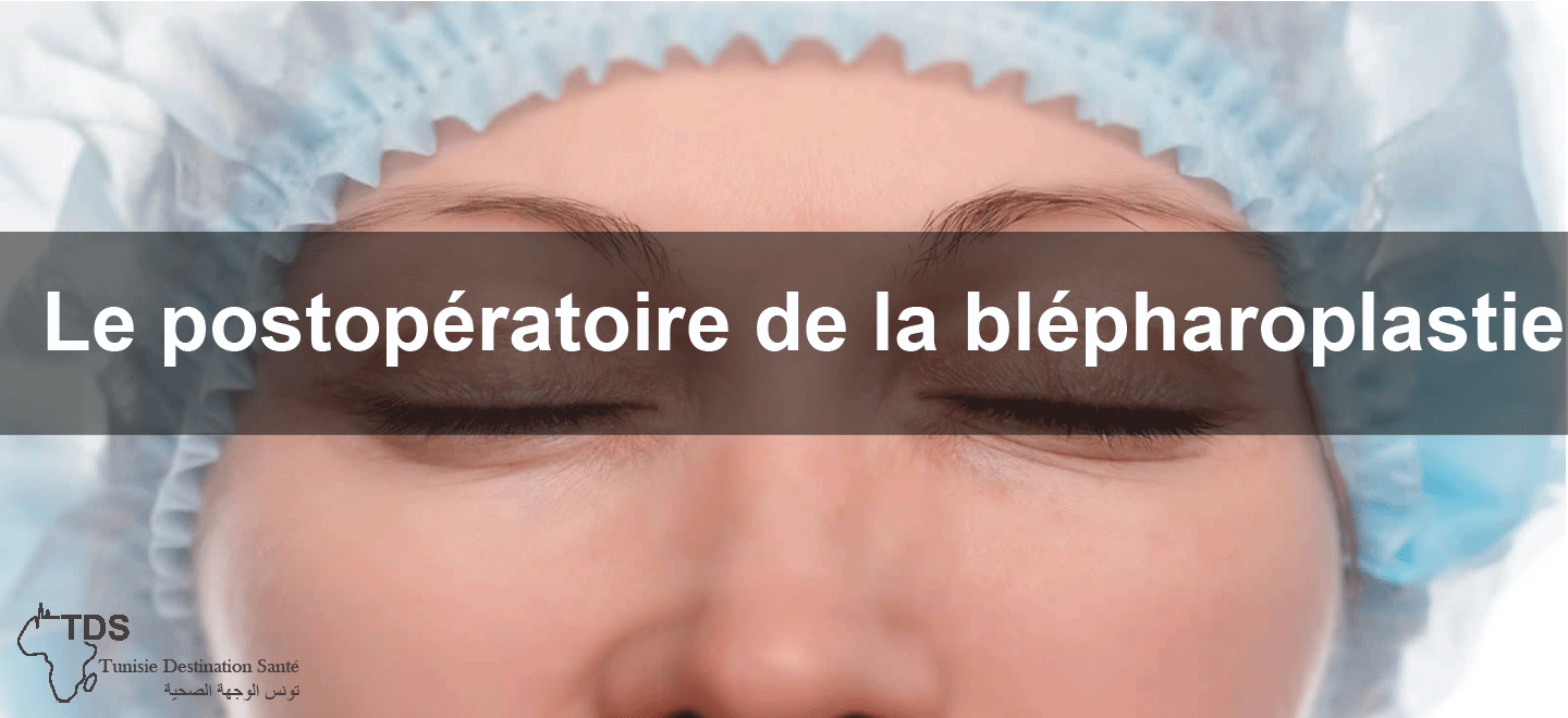 chirurgie esthetique blepharoplastie