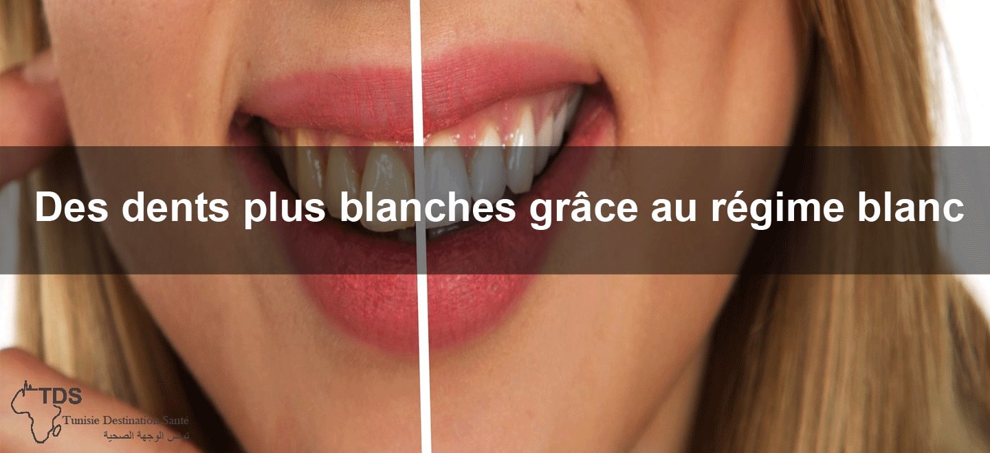 dents blanches