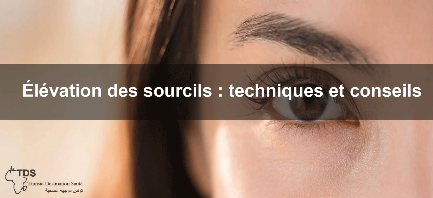 elevation sourcils