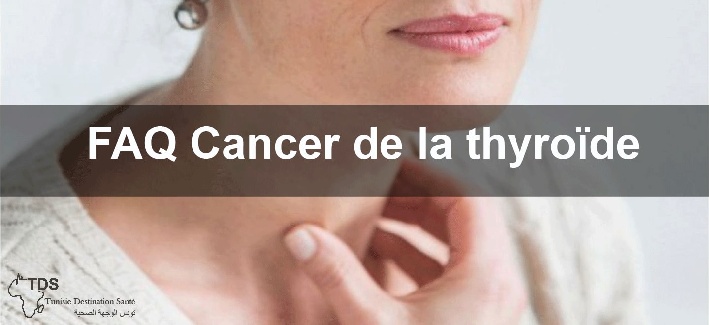 faq cancer thyroide