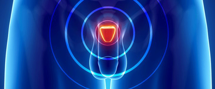Traitements du cancer de la prostate