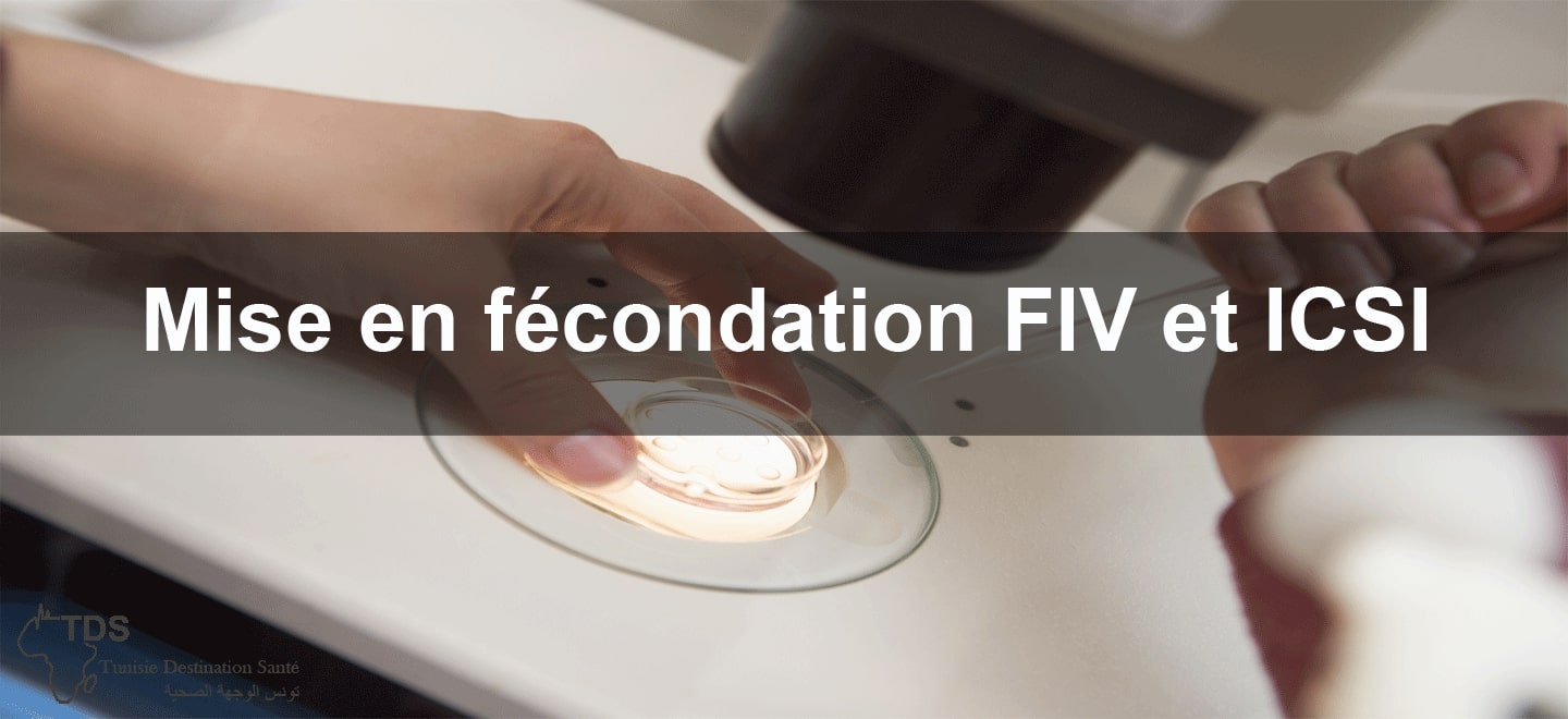 Mise en fecondation FIV-et ICSI TDS