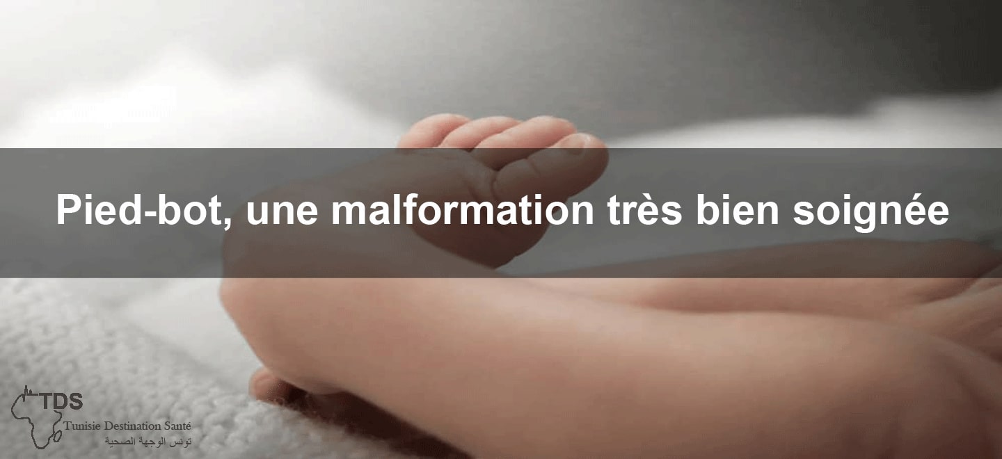 pieds bots malformation