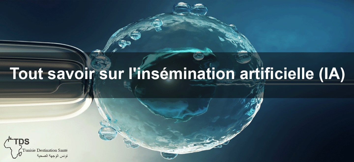 tout savoir insemination artificielle