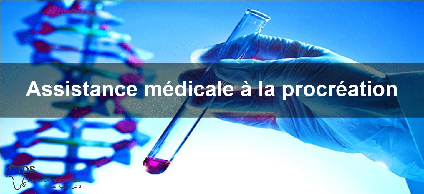 Assistance medicale a la procreation