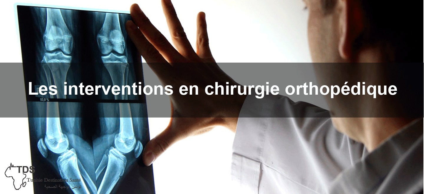 chirurgie orthopedique