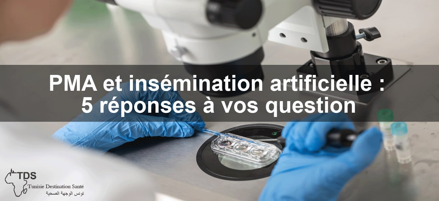 Pma insemination artificelle