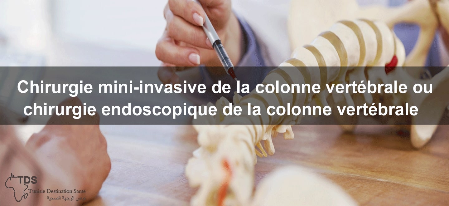 chirurgie endoscopique de la colonne vertebrale