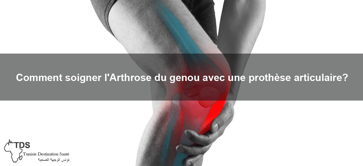 comment soulager l arthrose du genou