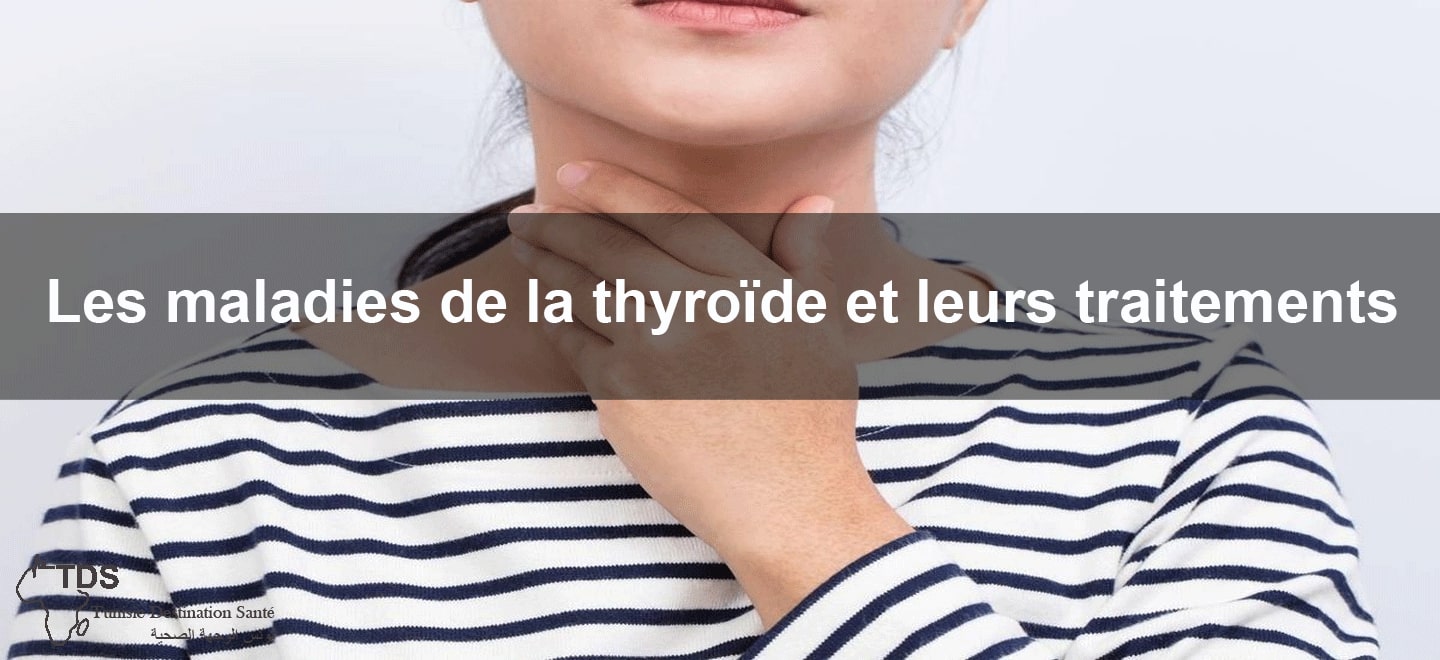 traitement maladies thyroide