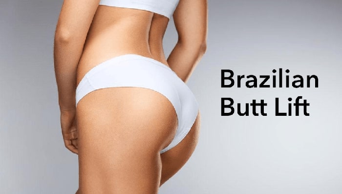 BBL Brazilian Butt Lift