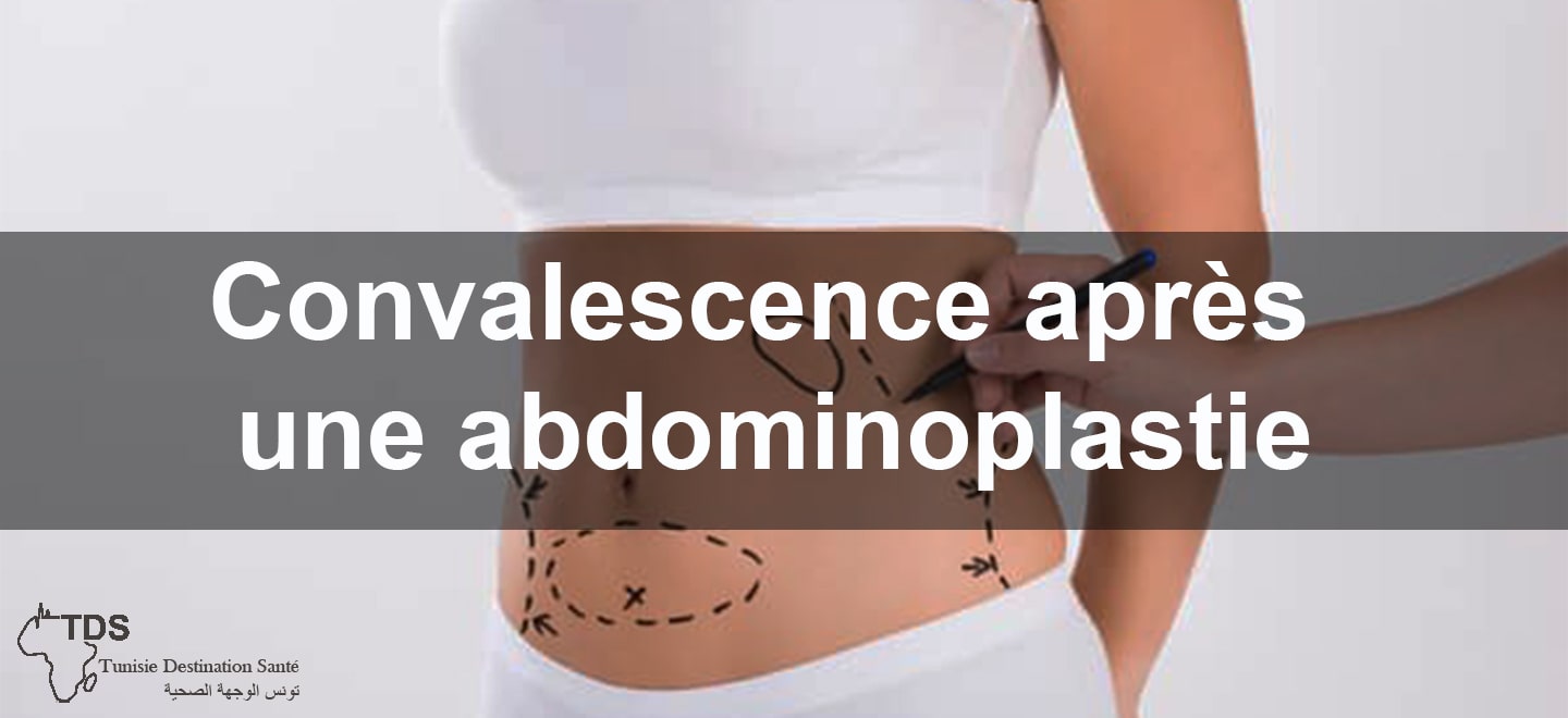 Convalescence apres une abdominoplastie