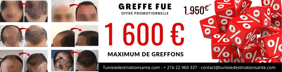 promo greffe cheveux