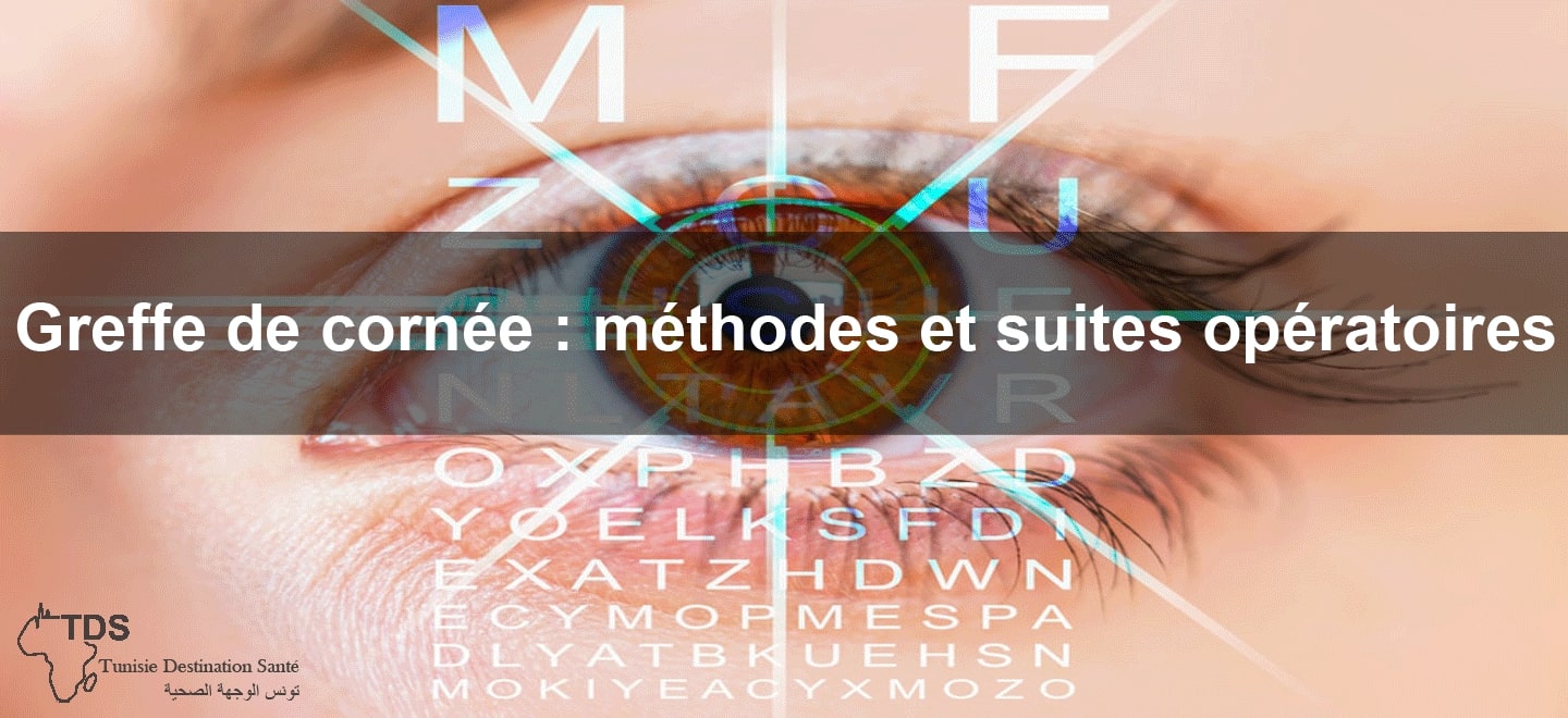 Greffe de cornee methodes suites operatoires