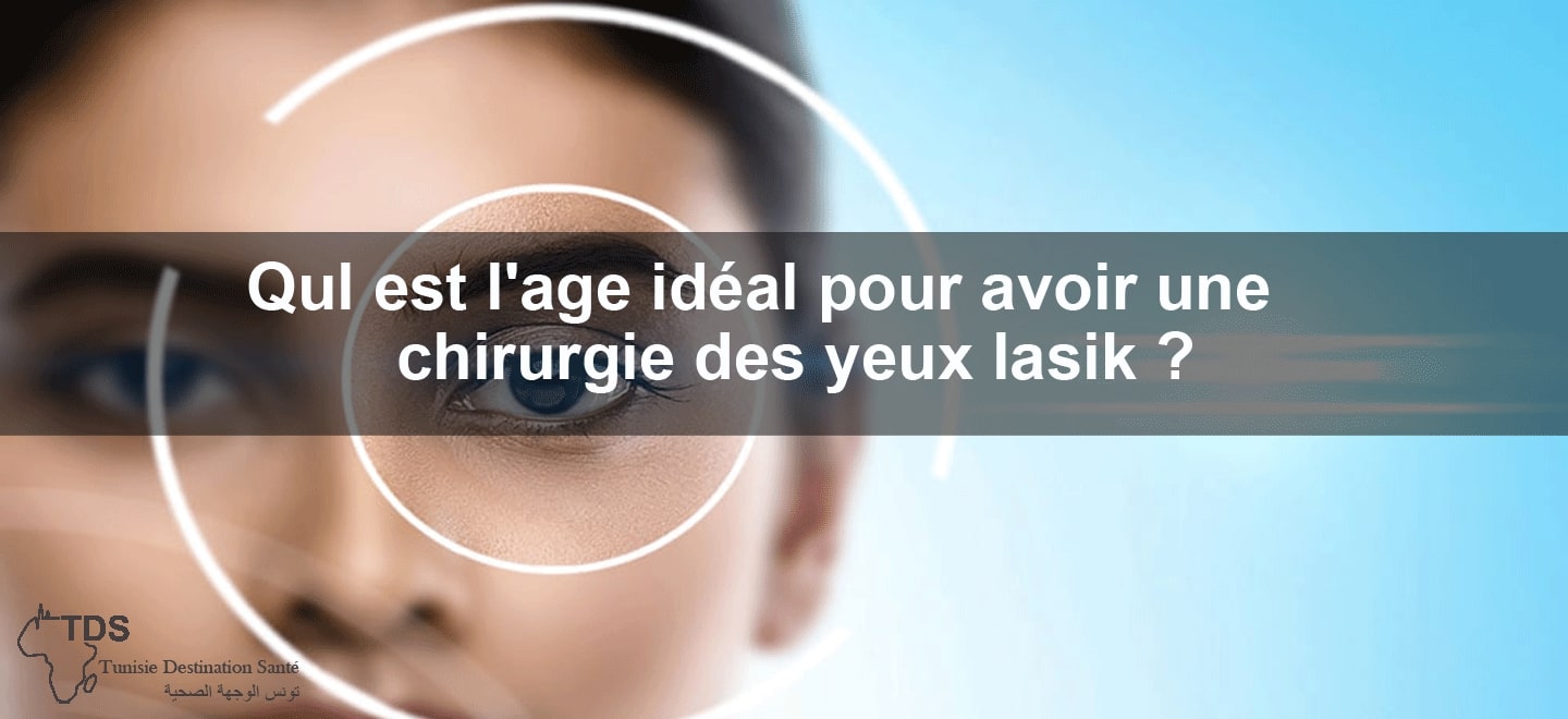 age chirurgie lasik